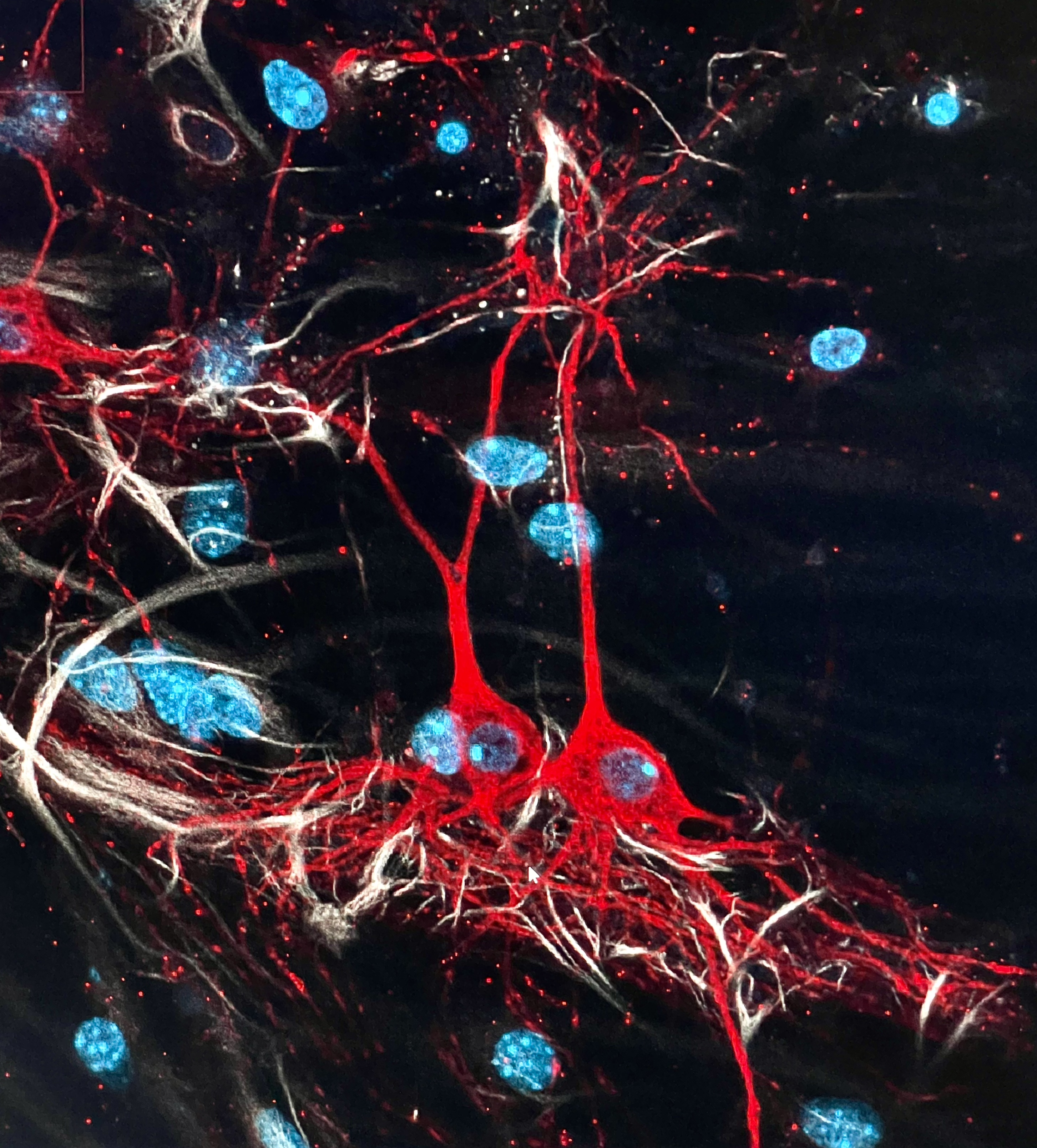 Fluorescence microscopy image of neural tissue with GFAP staining.